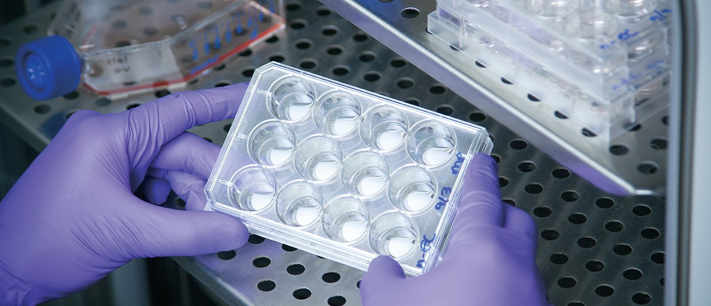 A person holding a tray for biological samples in a lab