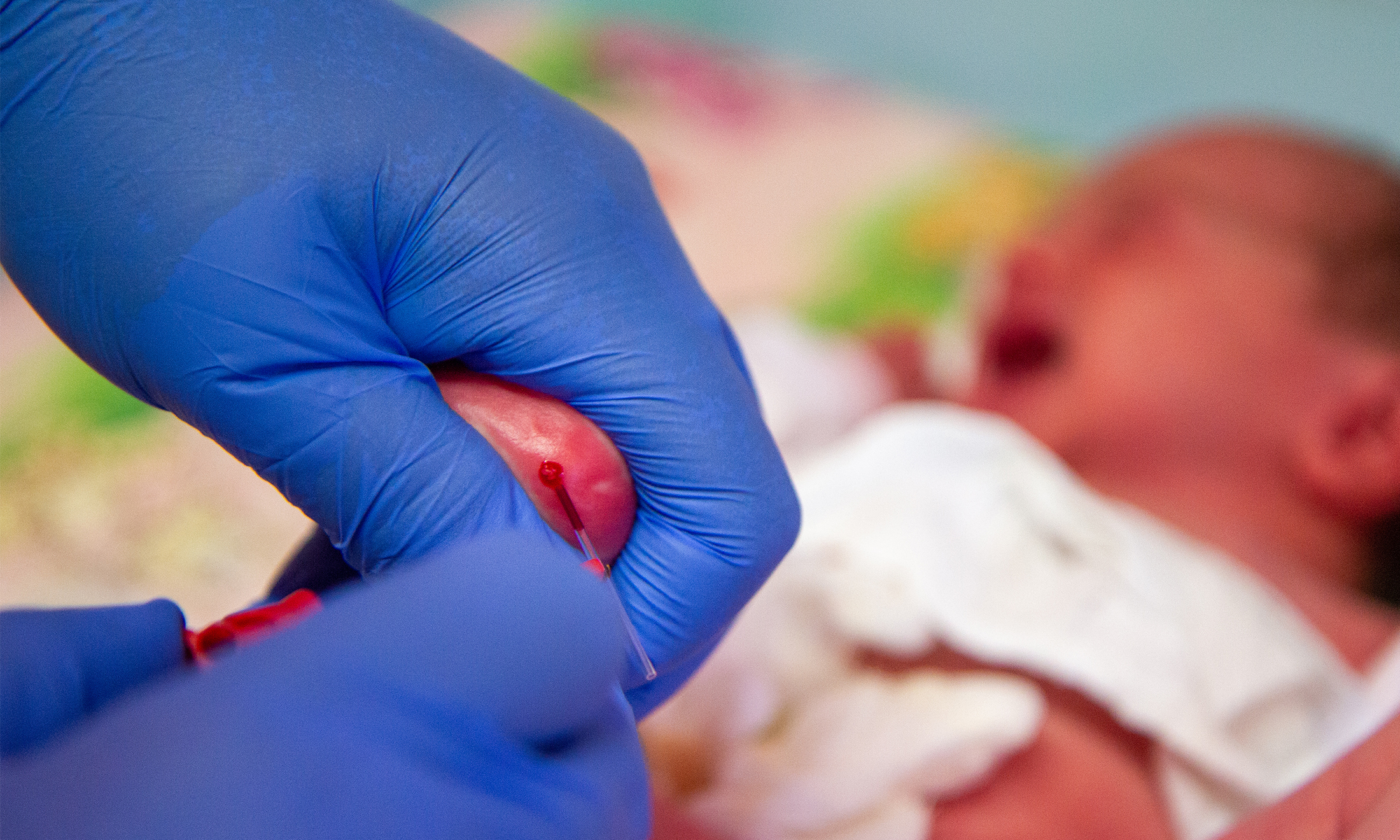 An image of a traditional baby heel prick